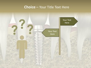 Orthodontist Steel Dentist PowerPoint Template