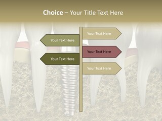 Orthodontist Steel Dentist PowerPoint Template