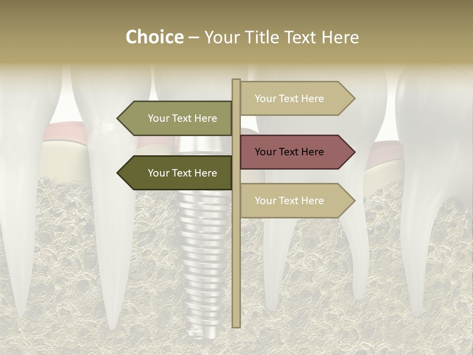 Orthodontist Steel Dentist PowerPoint Template