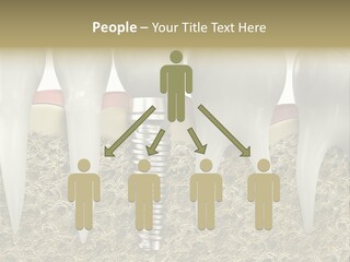 Orthodontist Steel Dentist PowerPoint Template
