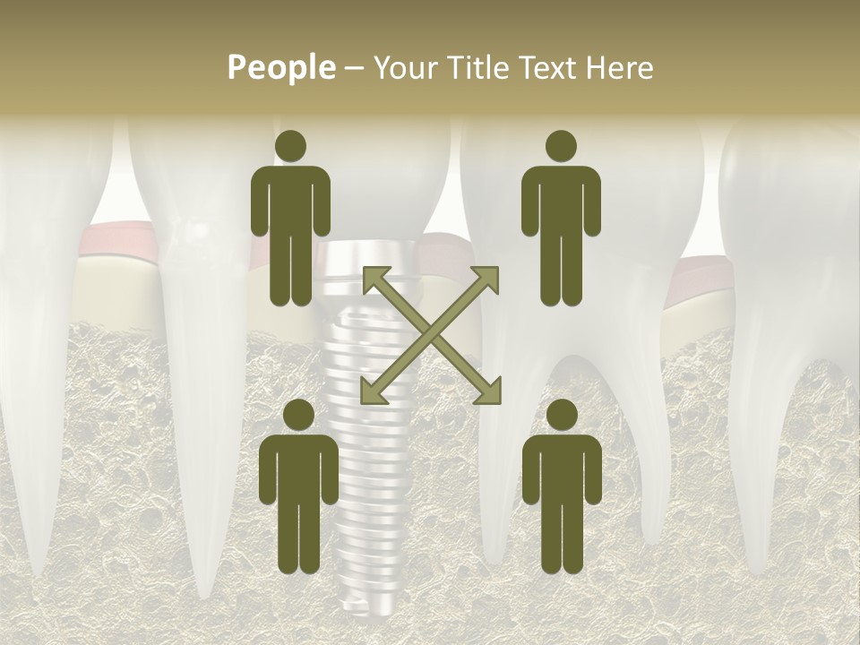 Orthodontist Steel Dentist PowerPoint Template