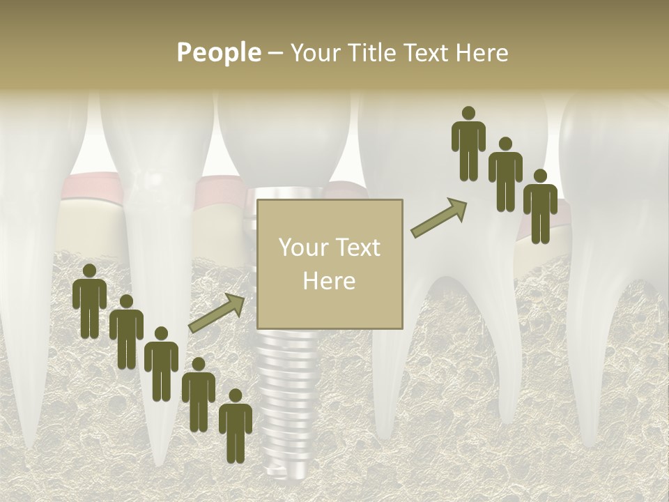 Orthodontist Steel Dentist PowerPoint Template