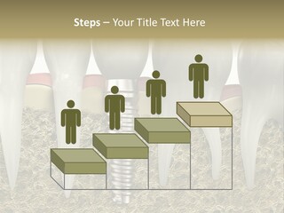 Orthodontist Steel Dentist PowerPoint Template