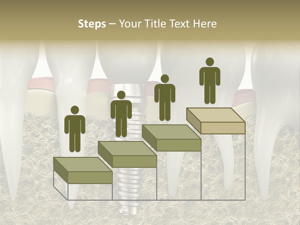 Orthodontist Steel Dentist PowerPoint Template