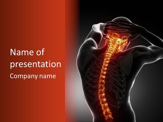 Trauma Ray Skeleton PowerPoint Template