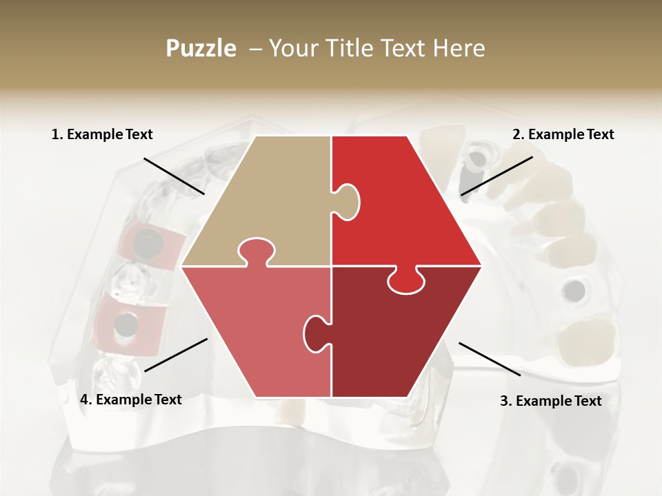 Denture Incisor Implant PowerPoint Template