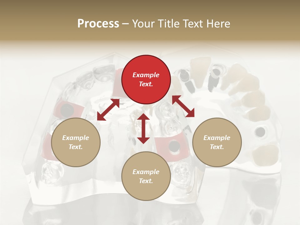 Denture Incisor Implant PowerPoint Template