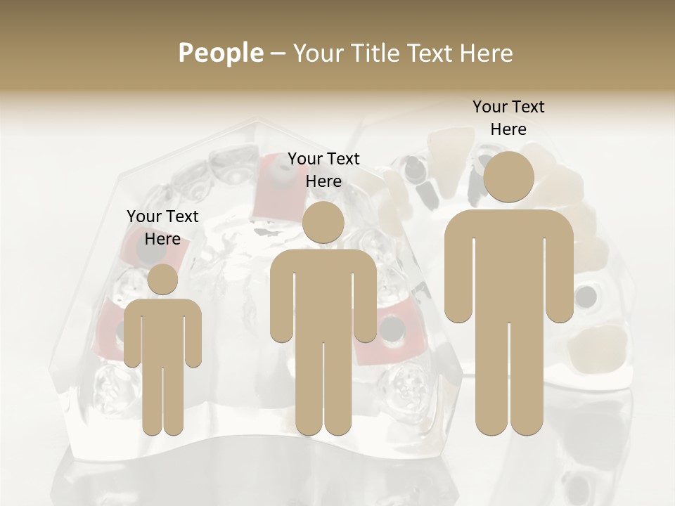 Denture Incisor Implant PowerPoint Template