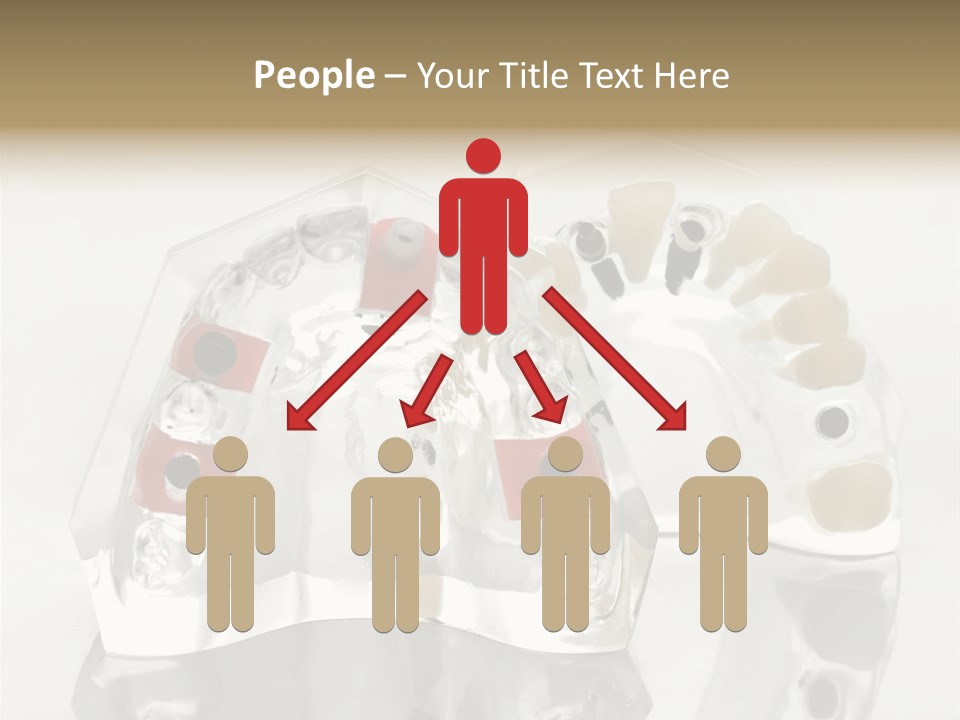 Denture Incisor Implant PowerPoint Template
