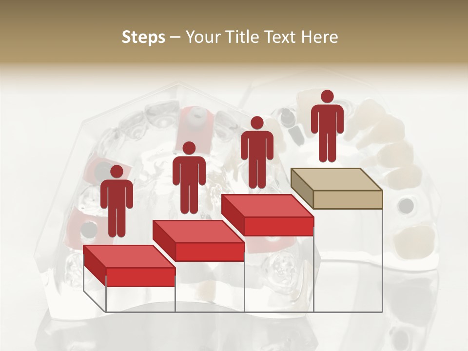 Denture Incisor Implant PowerPoint Template