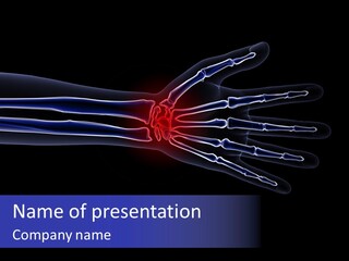 Medical Skeleton Pain PowerPoint Template