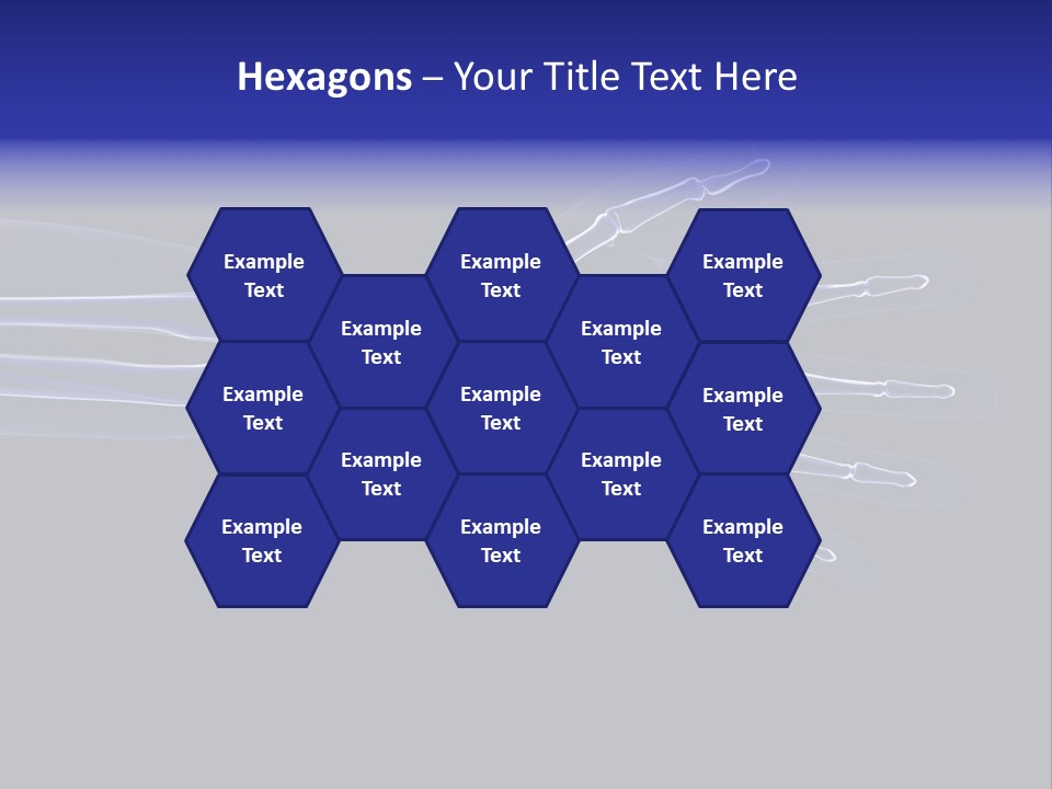 Medical Skeleton Pain PowerPoint Template