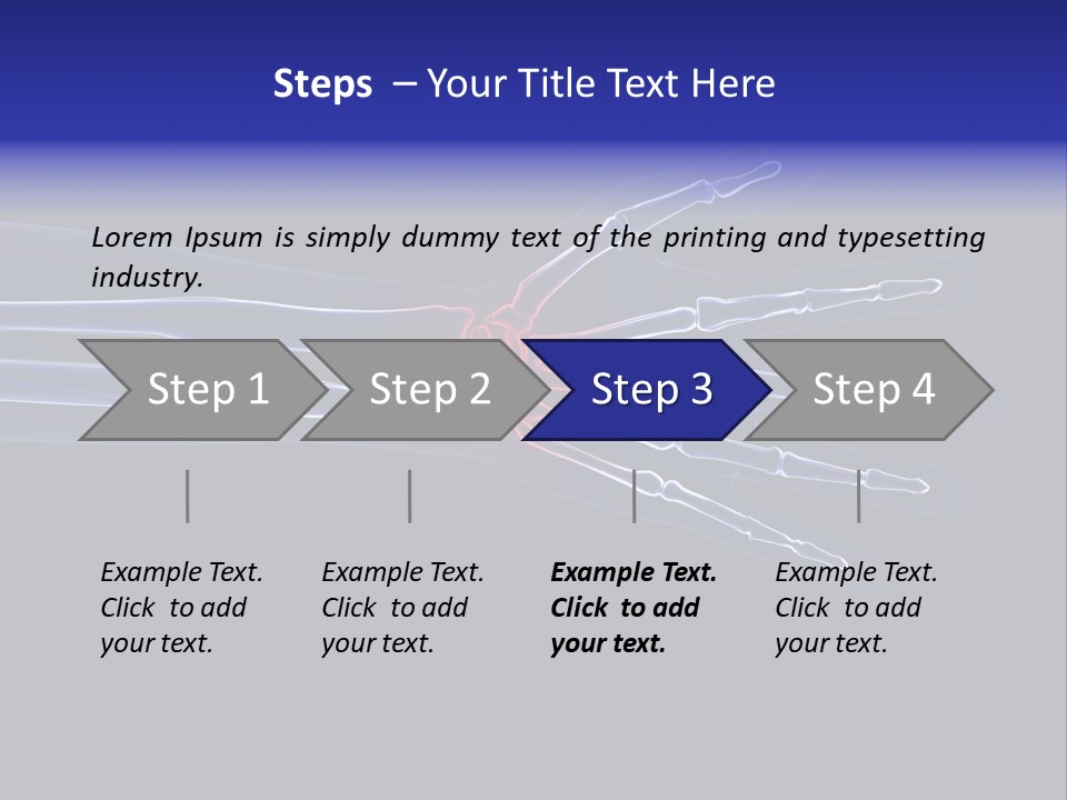 Medical Skeleton Pain PowerPoint Template