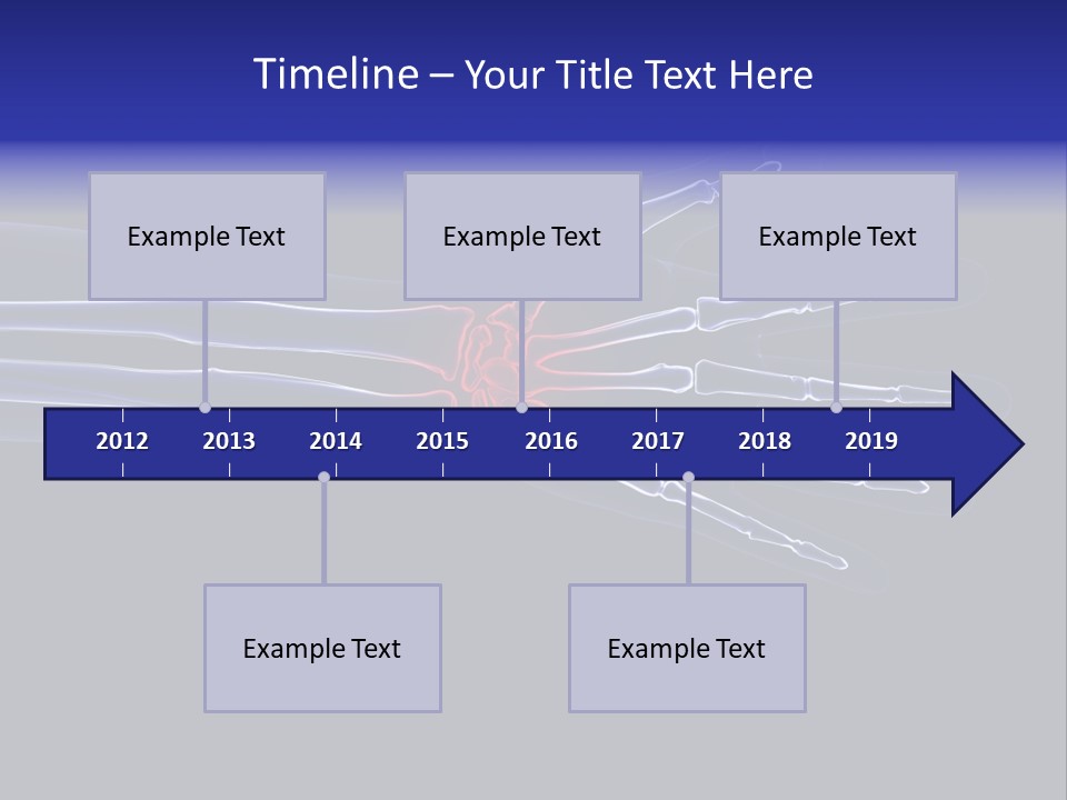 Medical Skeleton Pain PowerPoint Template