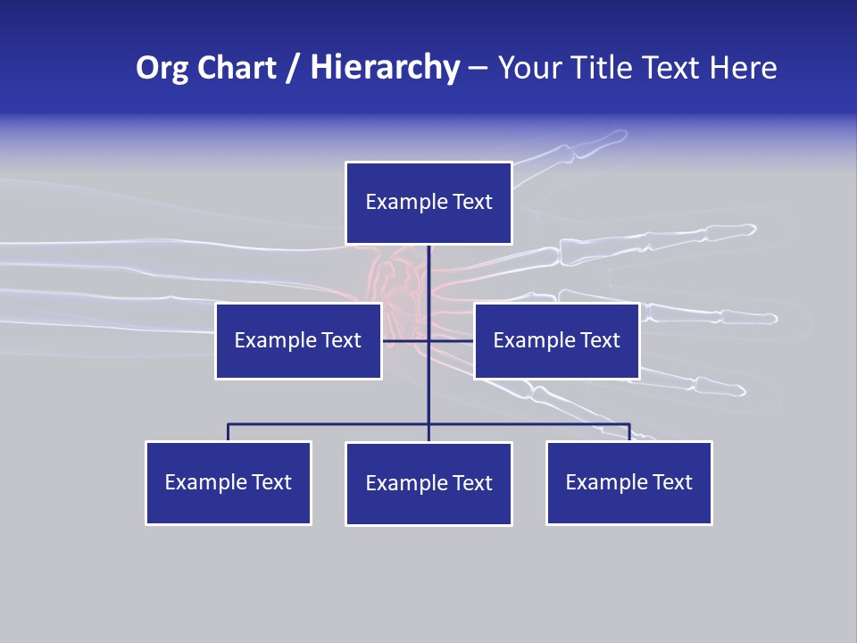 Medical Skeleton Pain PowerPoint Template
