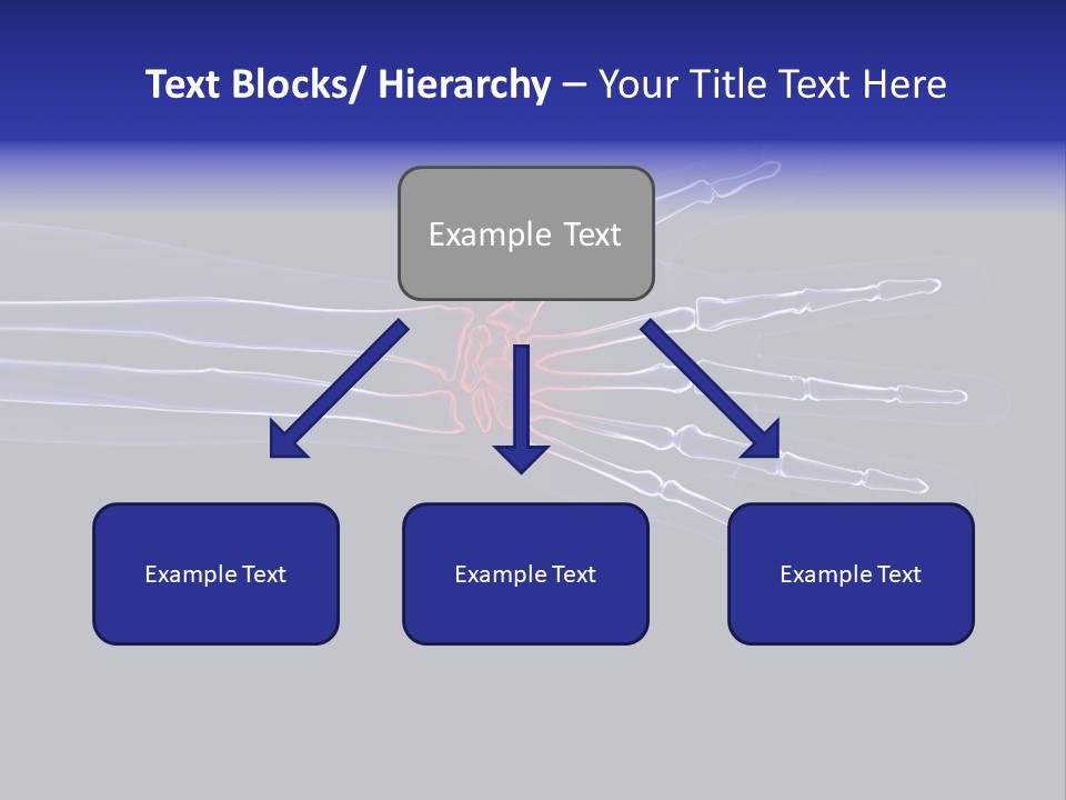 Medical Skeleton Pain PowerPoint Template
