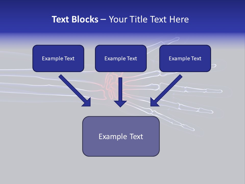 Medical Skeleton Pain PowerPoint Template