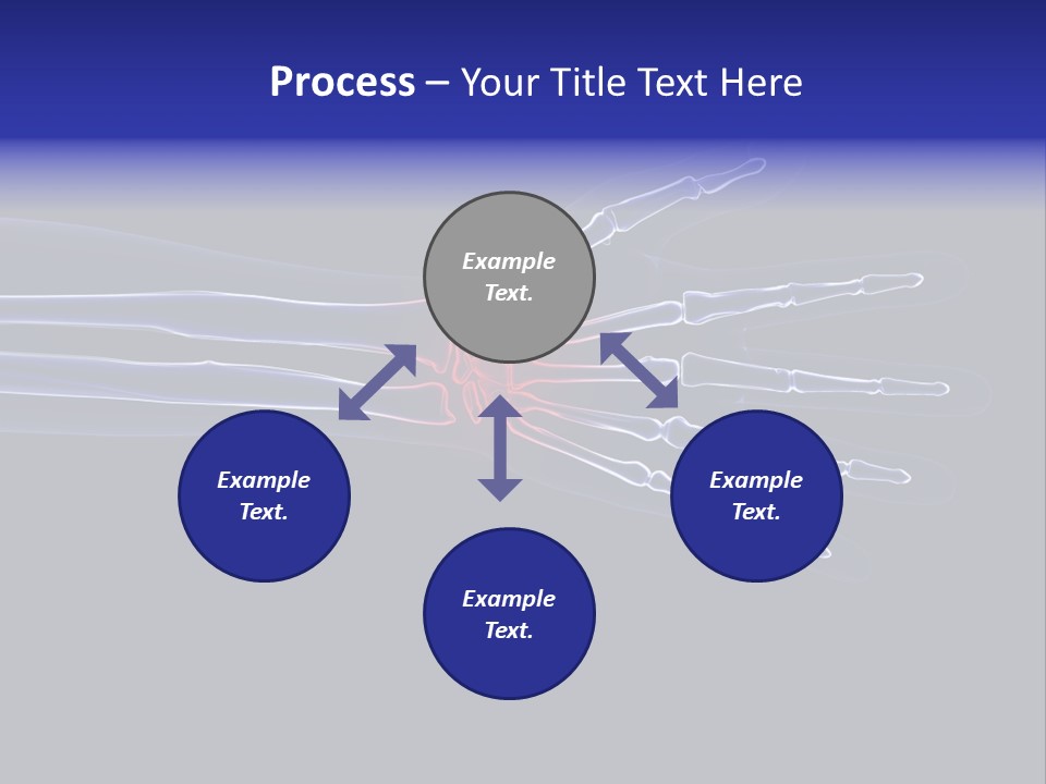 Medical Skeleton Pain PowerPoint Template