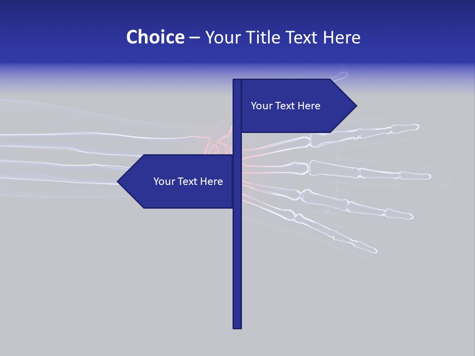 Medical Skeleton Pain PowerPoint Template