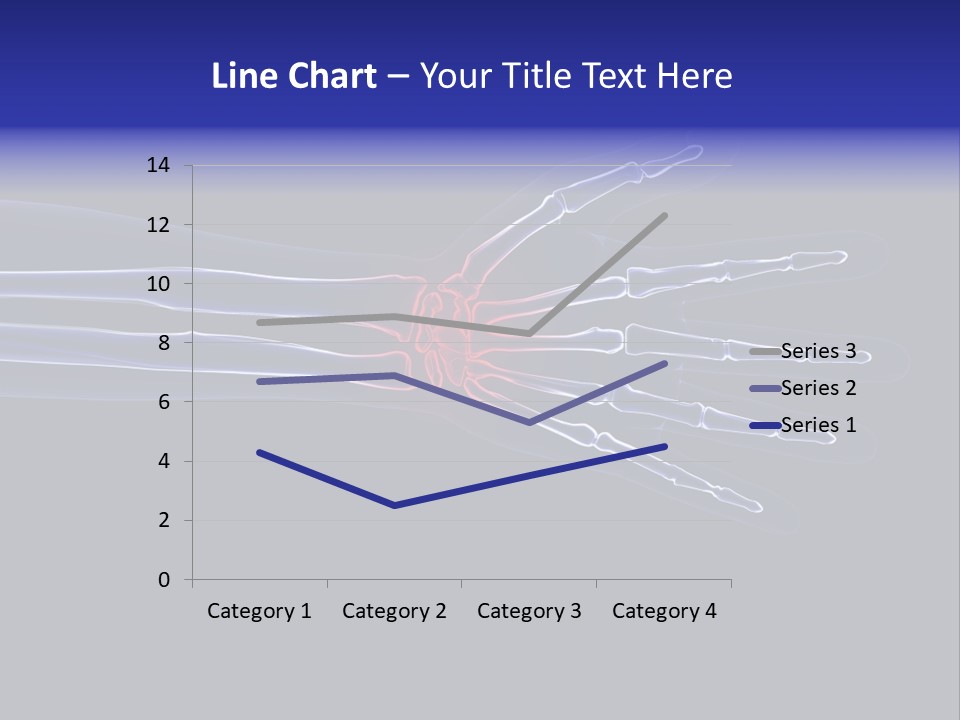 Medical Skeleton Pain PowerPoint Template
