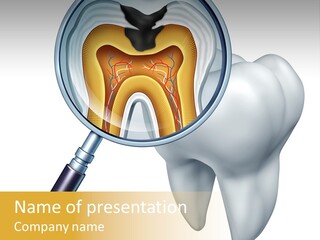 Tooth Cavity Filling PowerPoint Template