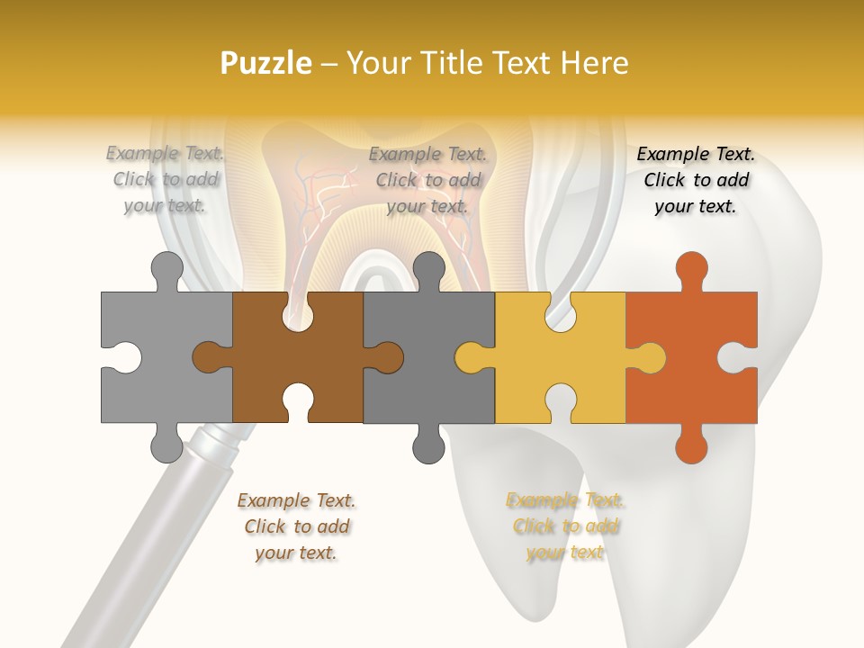 Tooth Cavity Filling PowerPoint Template