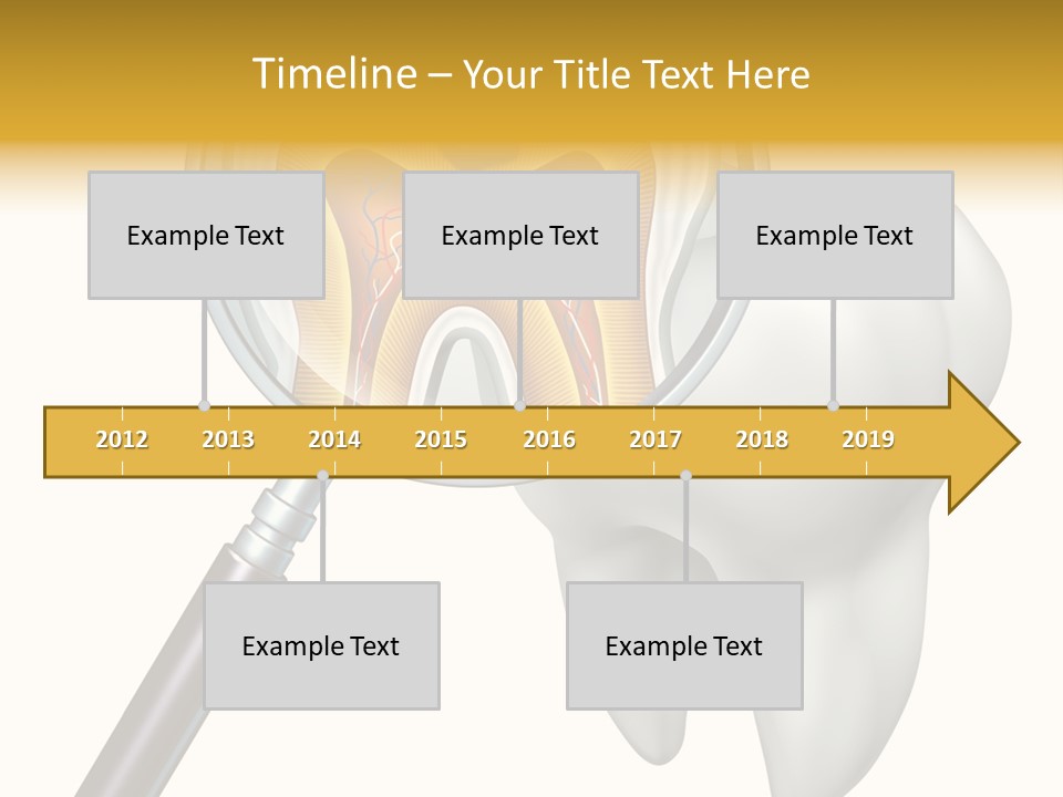 Tooth Cavity Filling PowerPoint Template