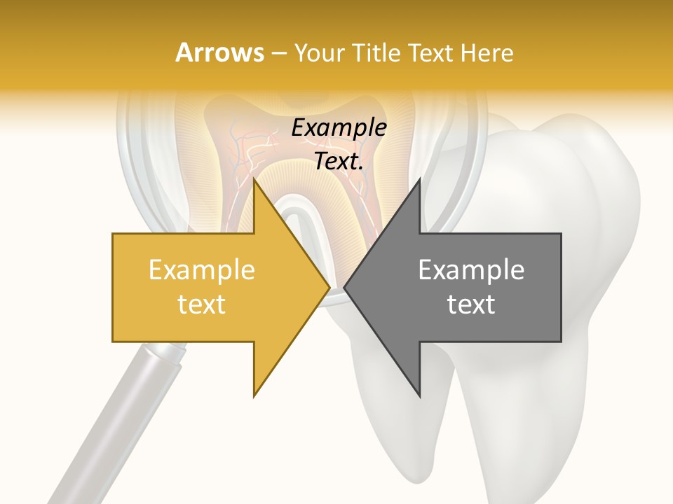 Tooth Cavity Filling PowerPoint Template