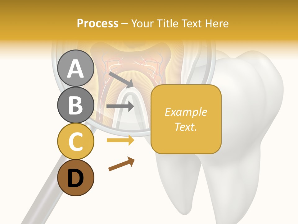 Tooth Cavity Filling PowerPoint Template