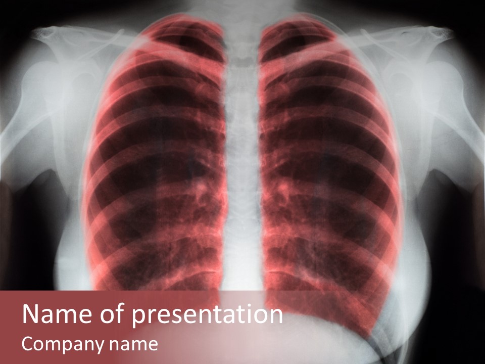 Exam Bronchitis Pulmonary PowerPoint Template