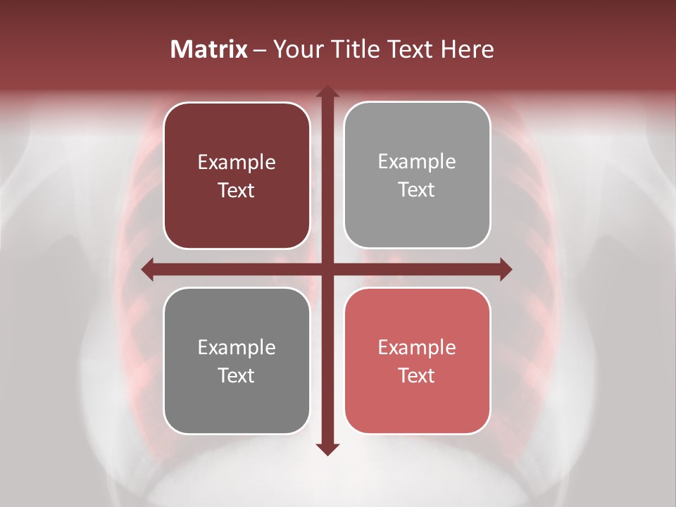 Exam Bronchitis Pulmonary PowerPoint Template