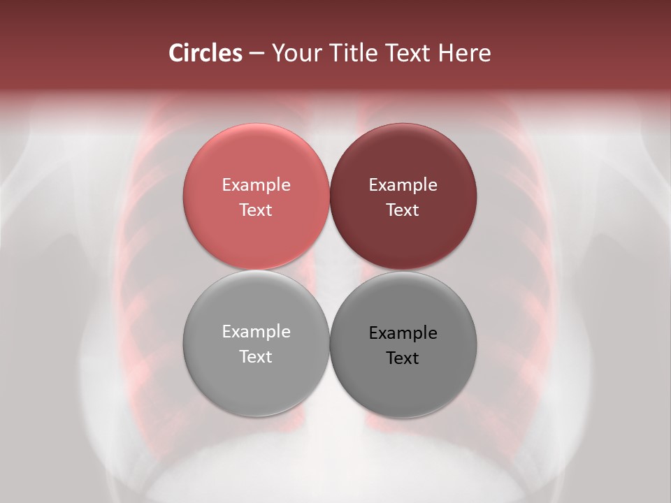Exam Bronchitis Pulmonary PowerPoint Template