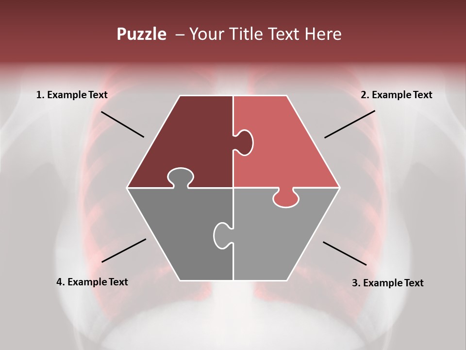 Exam Bronchitis Pulmonary PowerPoint Template