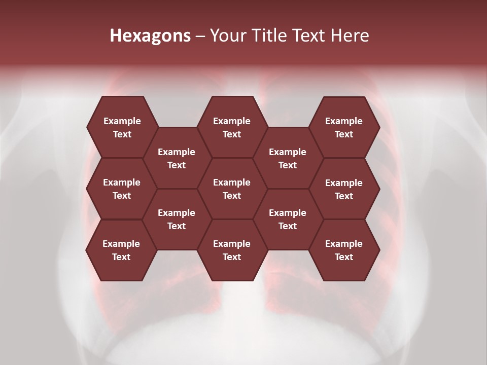 Exam Bronchitis Pulmonary PowerPoint Template
