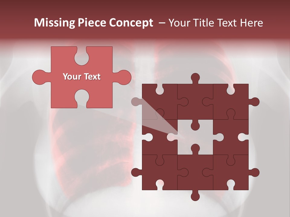 Exam Bronchitis Pulmonary PowerPoint Template