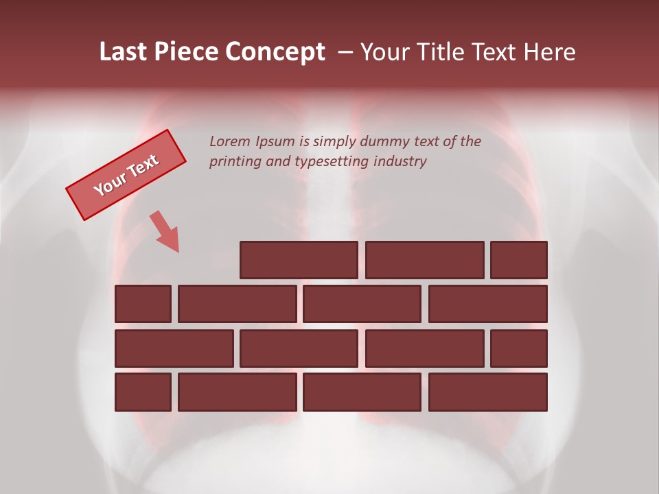 Exam Bronchitis Pulmonary PowerPoint Template