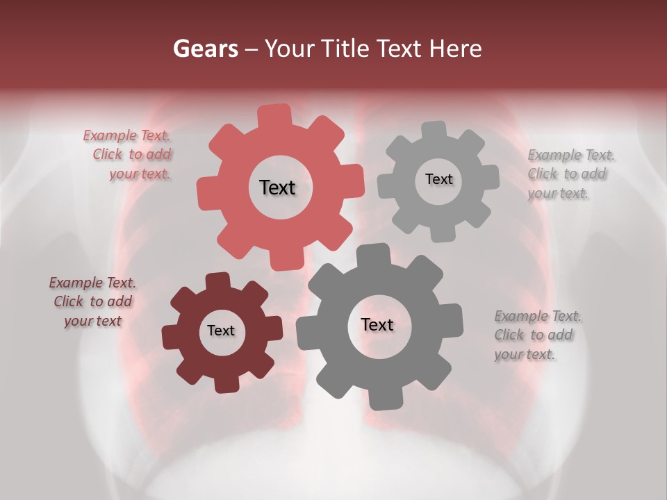 Exam Bronchitis Pulmonary PowerPoint Template