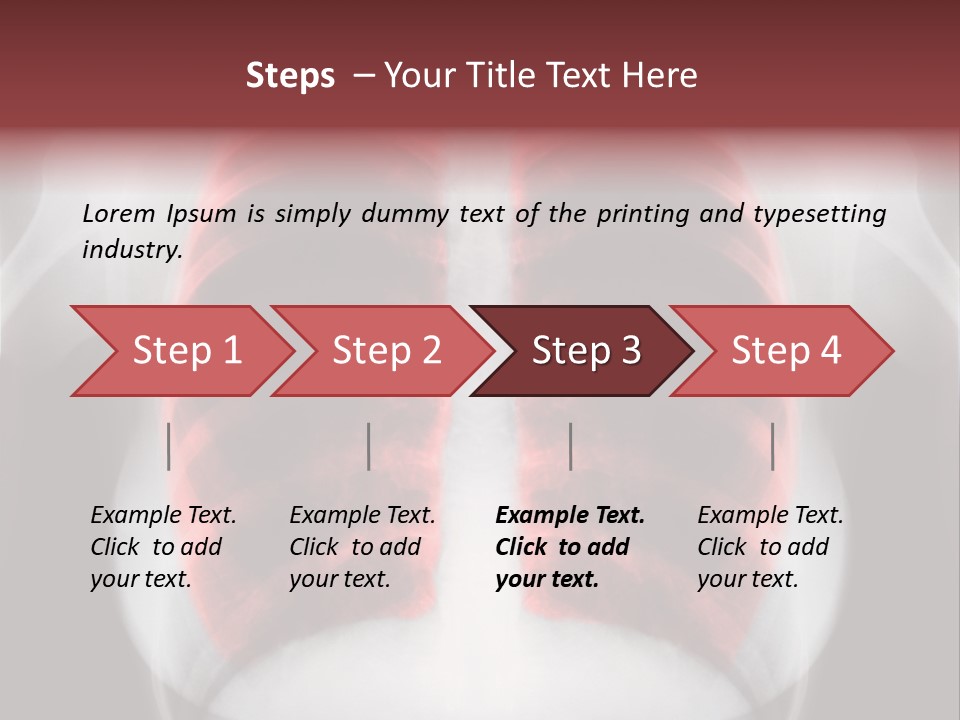 Exam Bronchitis Pulmonary PowerPoint Template