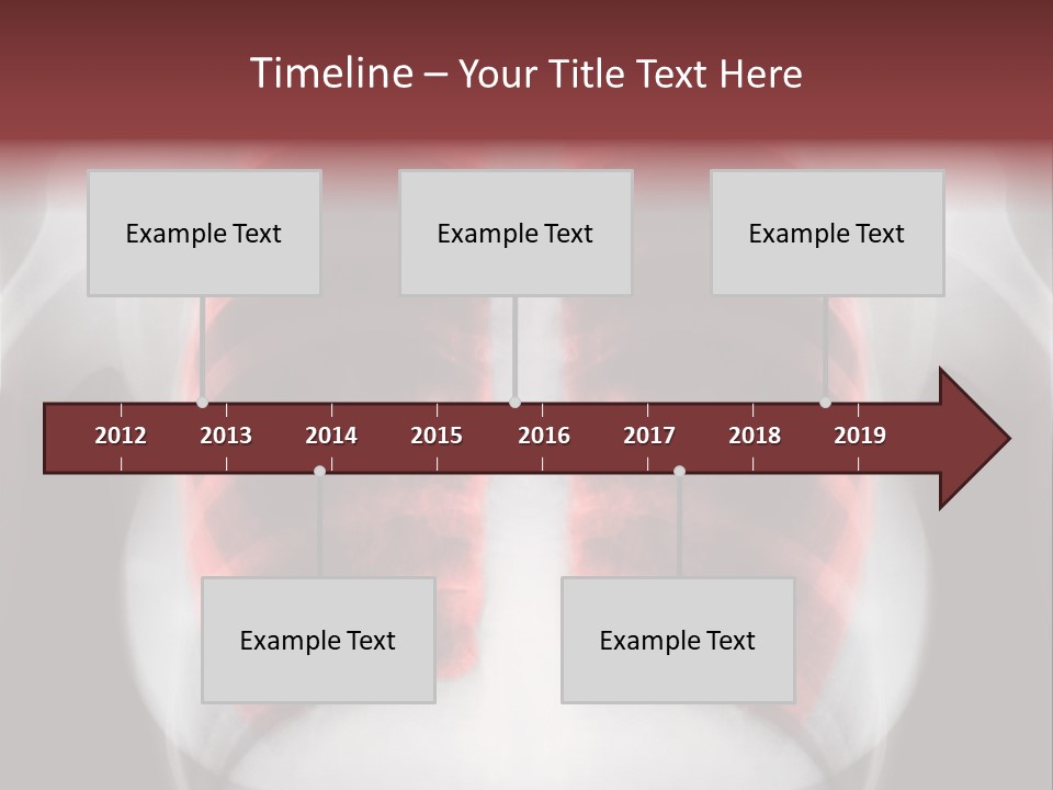 Exam Bronchitis Pulmonary PowerPoint Template
