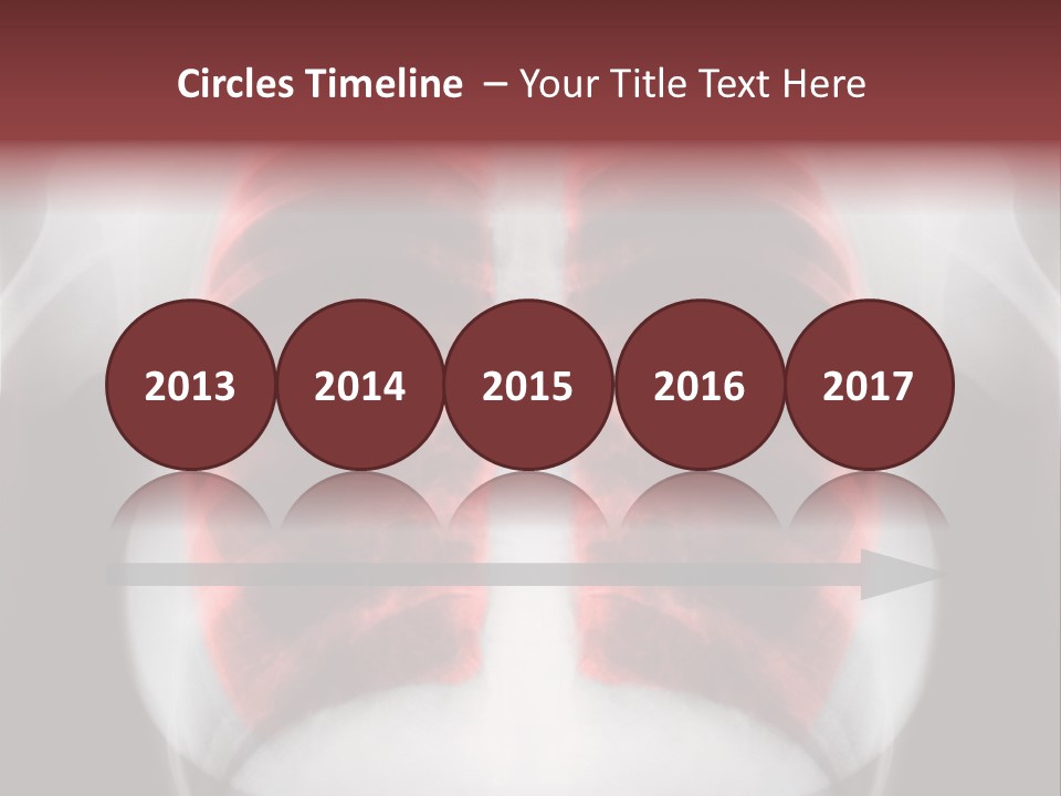 Exam Bronchitis Pulmonary PowerPoint Template