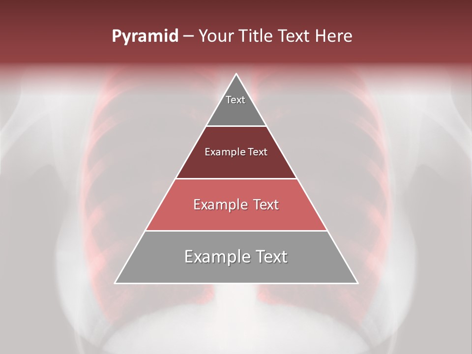 Exam Bronchitis Pulmonary PowerPoint Template