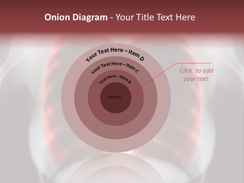 Exam Bronchitis Pulmonary PowerPoint Template
