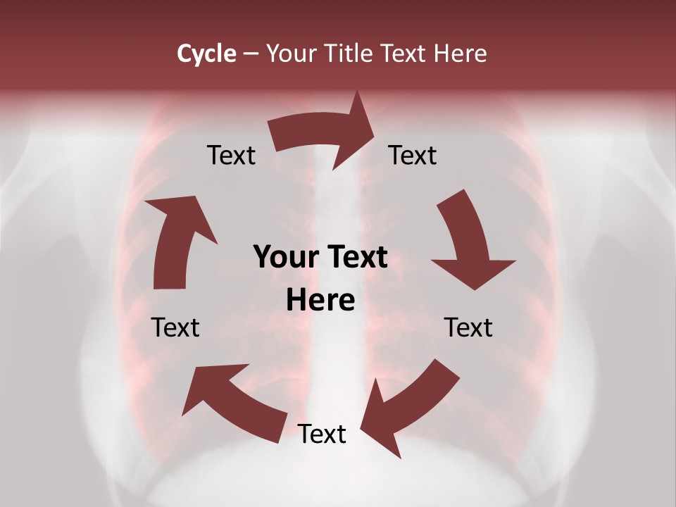 Exam Bronchitis Pulmonary PowerPoint Template