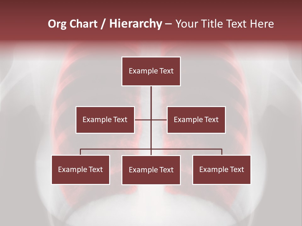 Exam Bronchitis Pulmonary PowerPoint Template