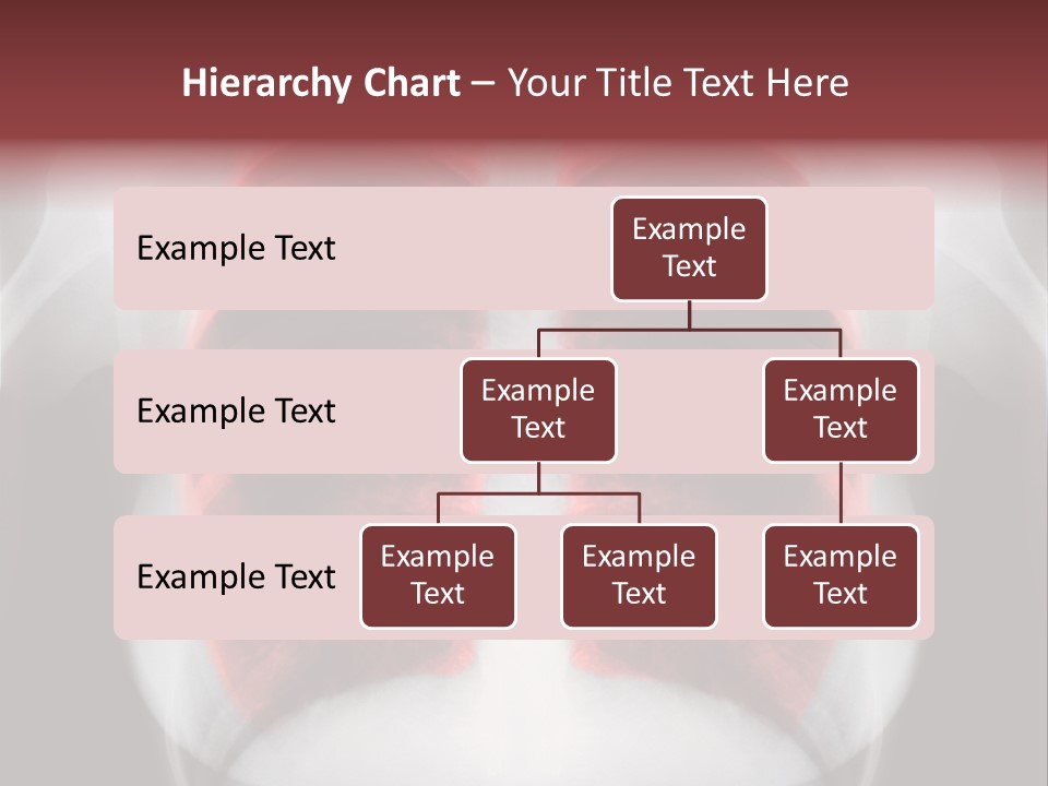 Exam Bronchitis Pulmonary PowerPoint Template
