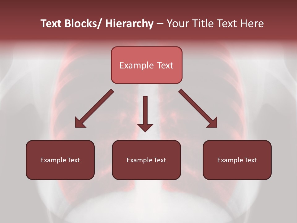 Exam Bronchitis Pulmonary PowerPoint Template