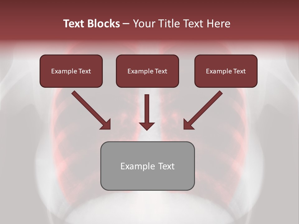 Exam Bronchitis Pulmonary PowerPoint Template