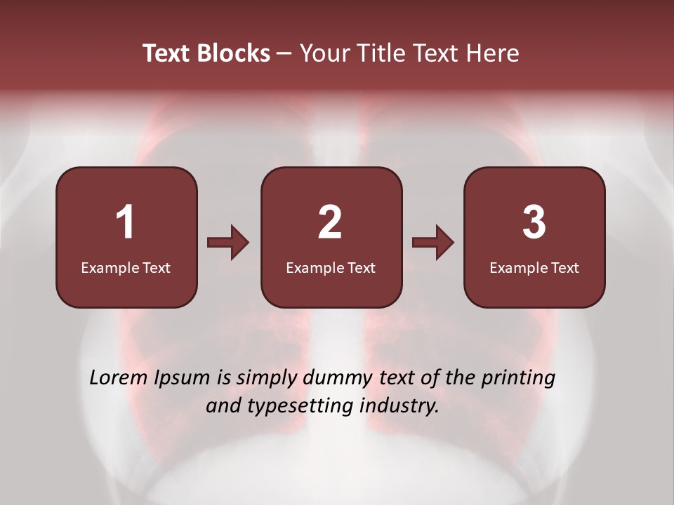 Exam Bronchitis Pulmonary PowerPoint Template