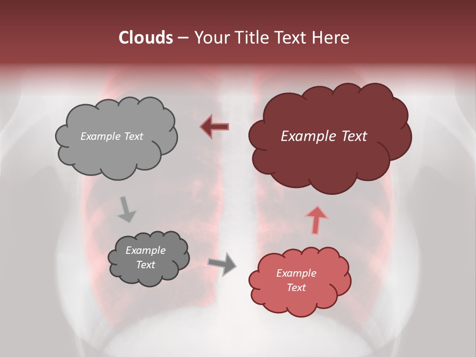 Exam Bronchitis Pulmonary PowerPoint Template
