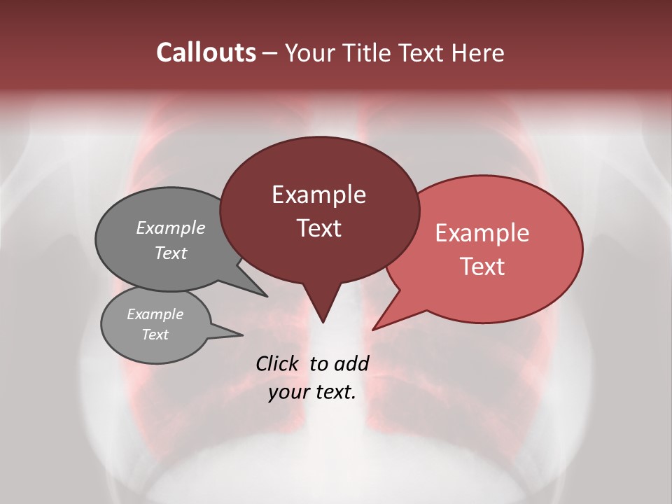 Exam Bronchitis Pulmonary PowerPoint Template